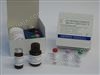 人组织多肽抗原（TPA）ELISA试剂盒