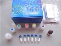 人诱导型一氧化氮合成酶（iNOS）ELISA试剂盒